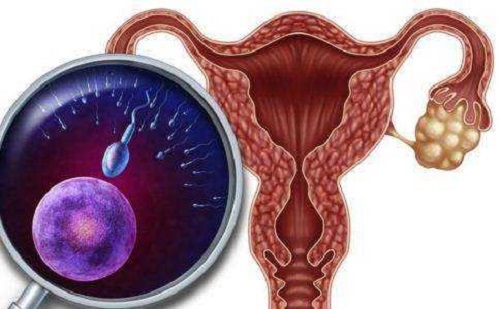 青海试管婴儿哪家好？多囊卵巢去的话要减肥吗？