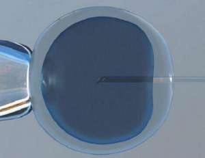 2021试管婴儿收费价目表一览